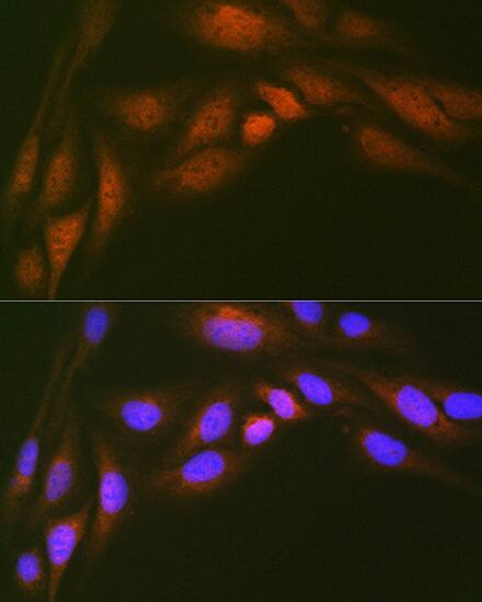 Immunocytochemistry/ Immunofluorescence: UBE2N/Ubc13 Antibody (10O9Z5) [NBP3-16793] - Immunofluorescence analysis of U-2 OS cells using UBE2N/Ubc13 Rabbit mAb at dilution of 1:100 (40x lens). Secondary antibody: Cy3 Goat Anti-Rabbit IgG (H+L) at 1:500 dilution. Blue: DAPI for nuclear staining.