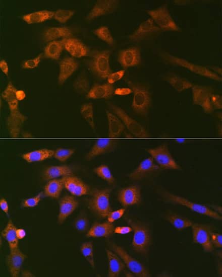 Immunocytochemistry/ Immunofluorescence: UBE2N/Ubc13 Antibody (10O9Z5) [NBP3-16793] - Immunofluorescence analysis of NIH/3T3 cells using UBE2N/Ubc13 Rabbit mAb at dilution of 1:100 (40x lens). Secondary antibody: Cy3 Goat Anti-Rabbit IgG (H+L) at 1:500 dilution. Blue: DAPI for nuclear staining.