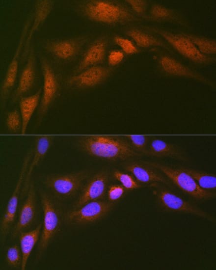 Immunocytochemistry/ Immunofluorescence: UBE2N/Ubc13 Antibody (10O9Z5) [UBE2N/Ubc13] - Immunofluorescence analysis of U-2 OS cells using UBE2N/Ubc13 Rabbit mAb  at dilution of 1:100 (40x lens). Secondary antibody: Cy3 Goat Anti-Rabbit IgG (H+L)  at 1:500 dilution. Blue: DAPI for nuclear staining.