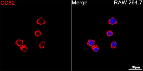 Immunocytochemistry/ Immunofluorescence: CD82/Kai-1 Antibody (0T3L6) [NBP3-16797] - Confocal imaging of RAW 264.7 cells using CD82/Kai-1 Rabbit mAb  followed by a further incubation with Cy3 Goat Anti-Rabbit IgG (H+L) . DAPI was used for nuclear staining (Blue). Objective: 100x.