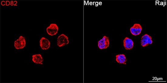 Immunocytochemistry/ Immunofluorescence: CD82/Kai-1 Antibody (0T3L6) [NBP3-16797] - Confocal imaging of Raji cells using CD82/Kai-1 Rabbit mAb followed by a further incubation with Cy3 Goat Anti-Rabbit IgG (H+L) . DAPI was used for nuclear staining (Blue). Objective: 100x.