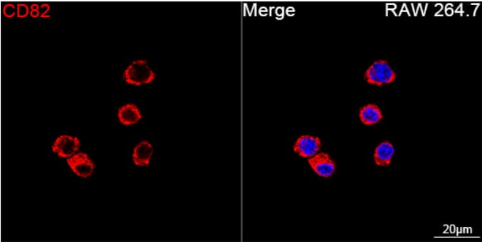 Immunocytochemistry/Immunofluorescence: CD82/Kai-1 Antibody (0T3L6) [NBP3-16797] - Confocal imaging of RAW 264.7 cells using CD82 Rabbit mAb (dilution 1:200) followed by a further incubation with Cy3 Goat Anti-Rabbit IgG (H+L) ( dilution 1:500) (Red). DAPI was used for nuclear staining (Blue). Objective: 100x.