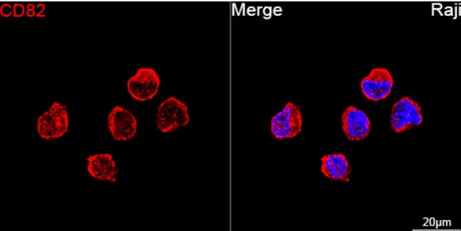 Immunocytochemistry/Immunofluorescence: CD82/Kai-1 Antibody (0T3L6) [NBP3-16797] - Confocal imaging of Raji cells using CD82 Rabbit mAb (dilution 1:200) followed by a further incubation with Cy3 Goat Anti-Rabbit IgG (H+L) (dilution 1:500) (Red). DAPI was used for nuclear staining (Blue). Objective: 100x.