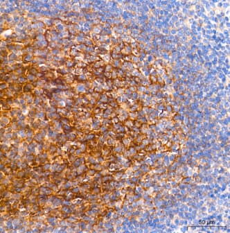 Immunohistochemistry-Paraffin: CD82/Kai-1 Antibody (0T3L6) [NBP3-16797] -Human tonsil tissue using CD82 Rabbit mAb at a dilution of 1:500 (40x lens). High pressure antigen retrieval performed with 0.01M Tris-EDTA Buffer (pH 9.0) prior to IHC staining.