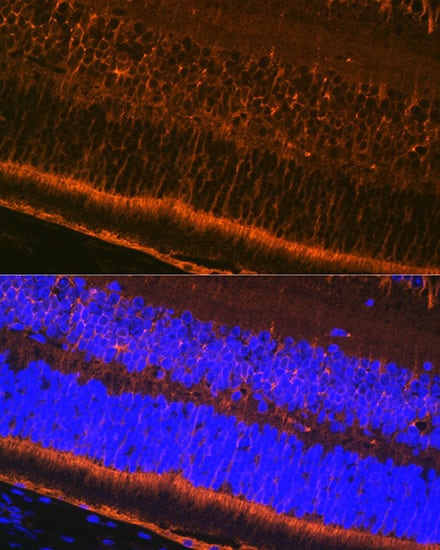 Immunocytochemistry/ Immunofluorescence: CRALBP Antibody (2M0G2) [NBP3-16798] - Immunofluorescence analysis of paraffin-embedded mouse eye using CRALBP Rabbit mAb at dilution of 1:100 (40x lens). Secondary antibody: Cy3-conjugated Goat anti-Rabbit IgG (H+L) at 1:500 dilution. Blue: DAPI for nuclear staining.