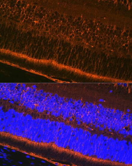 Immunocytochemistry/ Immunofluorescence: CRALBP Antibody (2M0G2) [CRALBP] - Immunofluorescence analysis of paraffin-embedded mouse eye using CRALBP Rabbit mAb  at dilution of 1:100 (40x lens). Secondary antibody: Cy3-conjugated Goat anti-Rabbit IgG (H+L)  at 1:500 dilution. Blue: DAPI for nuclear staining.