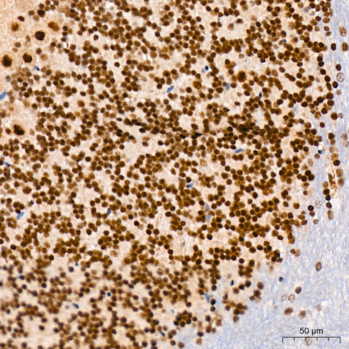 Immunohistochemistry: CaMKIV Antibody (1G4P4) [NBP3-16802] - Immunohistochemistry analysis of CaMKIV in paraffin-embedded mouse brain tissue using CaMKIV Rabbit mAb  at a dilution of 1:800 (40x lens). High pressure antigen retrieval was performed with 0.01 M citrate buffer (pH 6.0) prior to IHC staining.