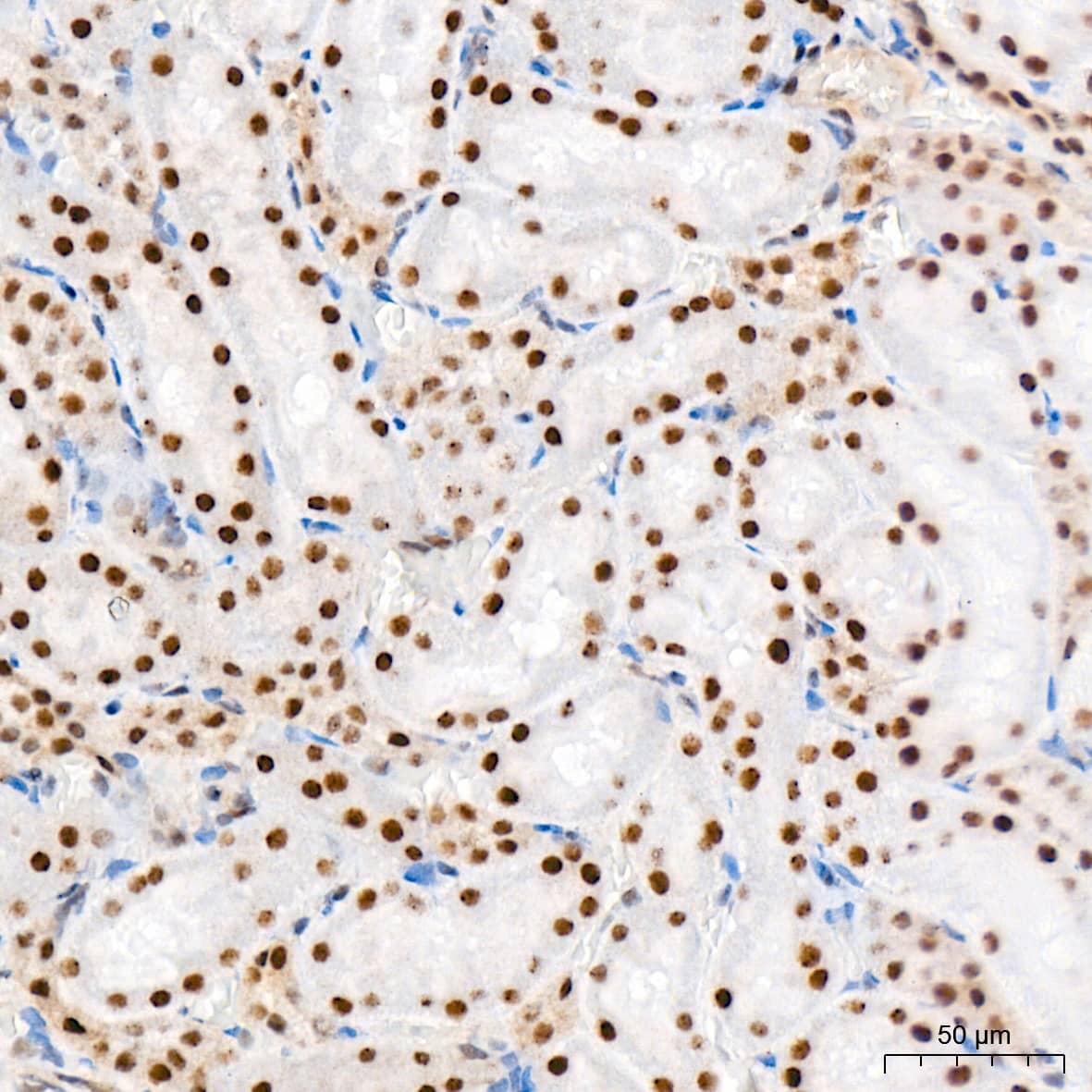 Immunohistochemistry: CaMKIV Antibody (1G4P4) [NBP3-16802] - Immunohistochemistry analysis of CaMKIV in paraffin-embedded rat kidney tissue using CaMKIV Rabbit mAb  at a dilution of 1:800 (40x lens). High pressure antigen retrieval was performed with 0.01 M citrate buffer (pH 6.0) prior to IHC staining.