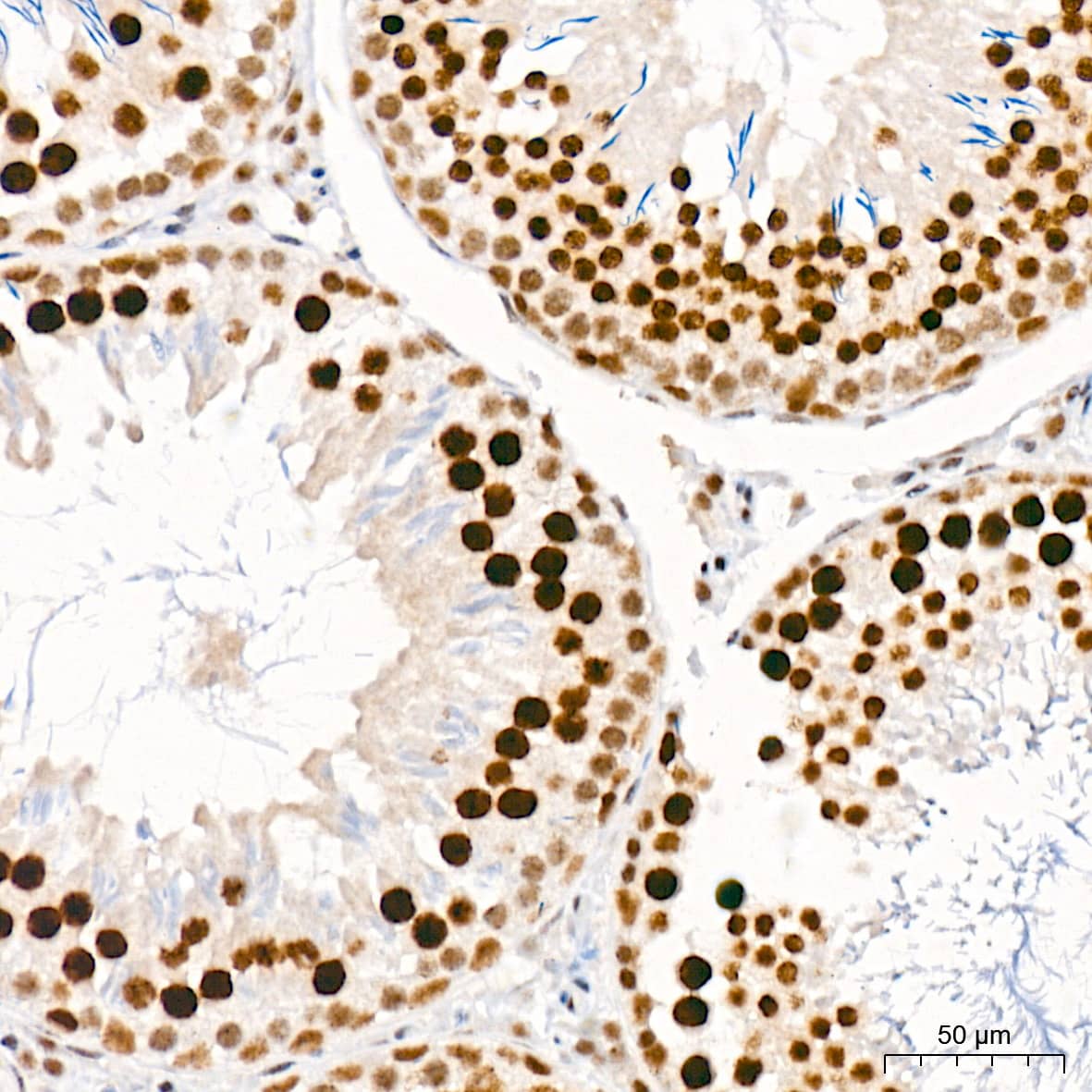 Immunohistochemistry: CaMKIV Antibody (1G4P4) [NBP3-16802] - Immunohistochemistry analysis of CaMKIV in paraffin-embedded rat testis tissue using CaMKIV Rabbit mAb  at a dilution of 1:800 (40x lens). High pressure antigen retrieval was performed with 0.01 M citrate buffer (pH 6.0) prior to IHC staining.