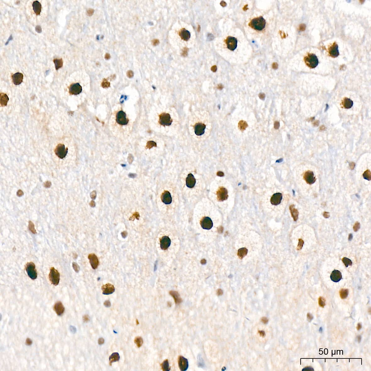 Immunohistochemistry: CaMKIV Antibody (1G4P4) [NBP3-16802] - Immunohistochemistry analysis of CaMKIV in paraffin-embedded rat brain tissue using CaMKIV Rabbit mAb  at a dilution of 1:800 (40x lens). High pressure antigen retrieval was performed with 0.01 M citrate buffer (pH 6.0) prior to IHC staining.