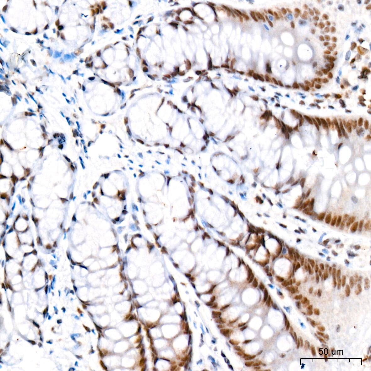 Immunohistochemistry: CaMKIV Antibody (1G4P4) [NBP3-16802] - Immunohistochemistry analysis of CaMKIV in paraffin-embedded rat colon tissue using CaMKIV Rabbit mAb  at a dilution of 1:800 (40x lens). High pressure antigen retrieval was performed with 0.01 M citrate buffer (pH 6.0) prior to IHC staining.