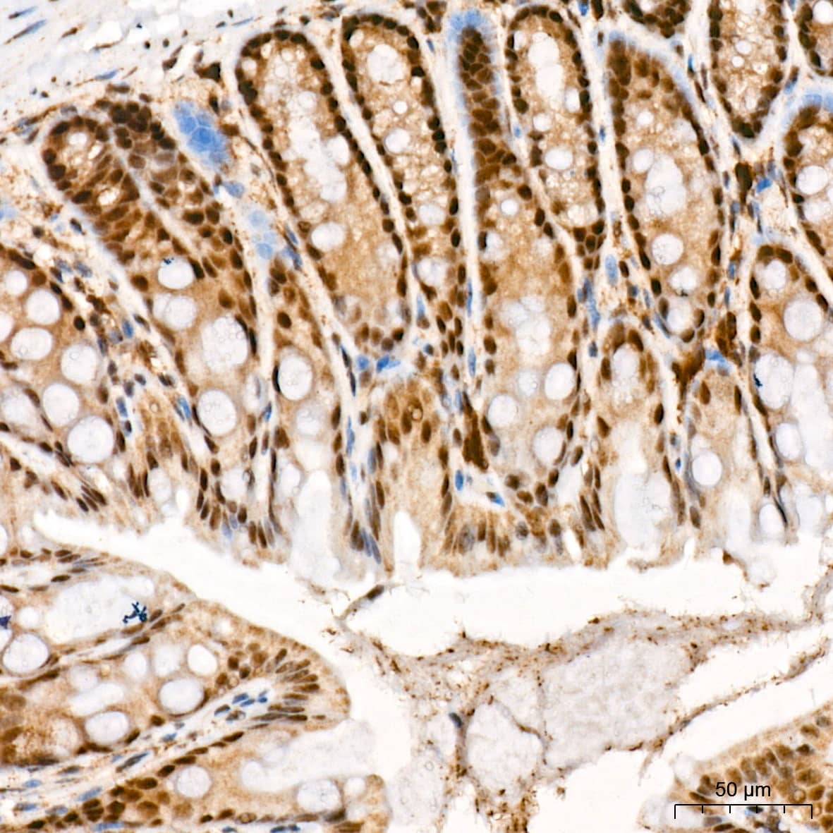 Immunohistochemistry: CaMKIV Antibody (1G4P4) [NBP3-16802] - Immunohistochemistry analysis of CaMKIV in paraffin-embedded mouse colon tissue using CaMKIV Rabbit mAb  at a dilution of 1:800 (40x lens). High pressure antigen retrieval was performed with 0.01 M citrate buffer (pH 6.0) prior to IHC staining.