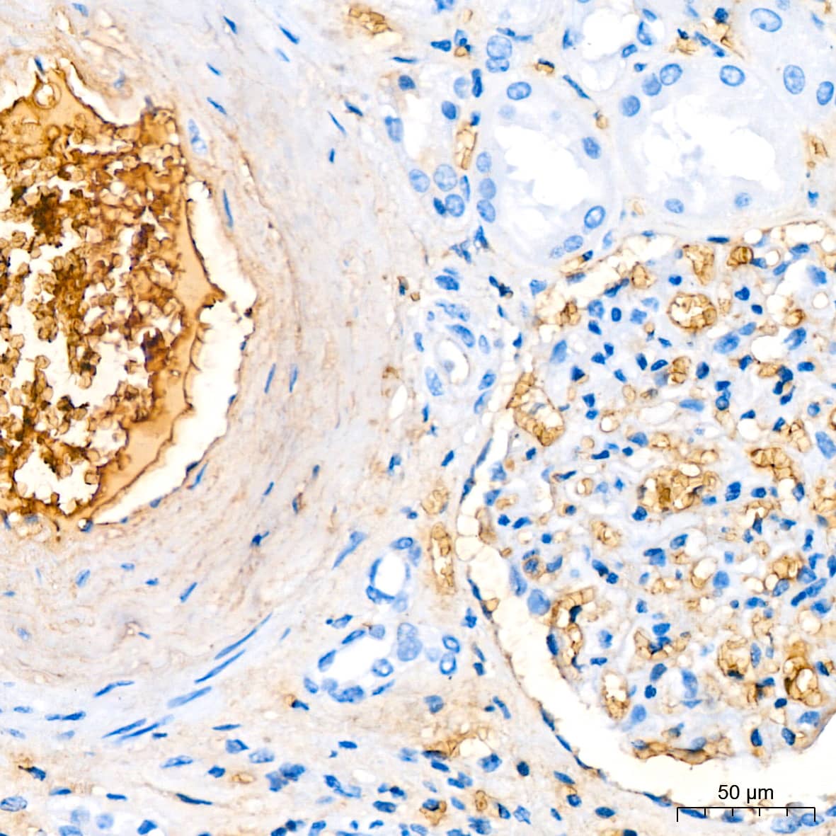 Immunohistochemistry: Hemoglobin A1 Antibody (1R1N7) [NBP3-16804] - Immunohistochemistry analysis of paraffin-embedded Human kidney tissue using Hemoglobin A1 Rabbit mAb at a dilution of 1:200 (40x lens). High pressure antigen retrieval performed with 0.01M Citrate Buffer (pH 6.0) prior to IHC staining.