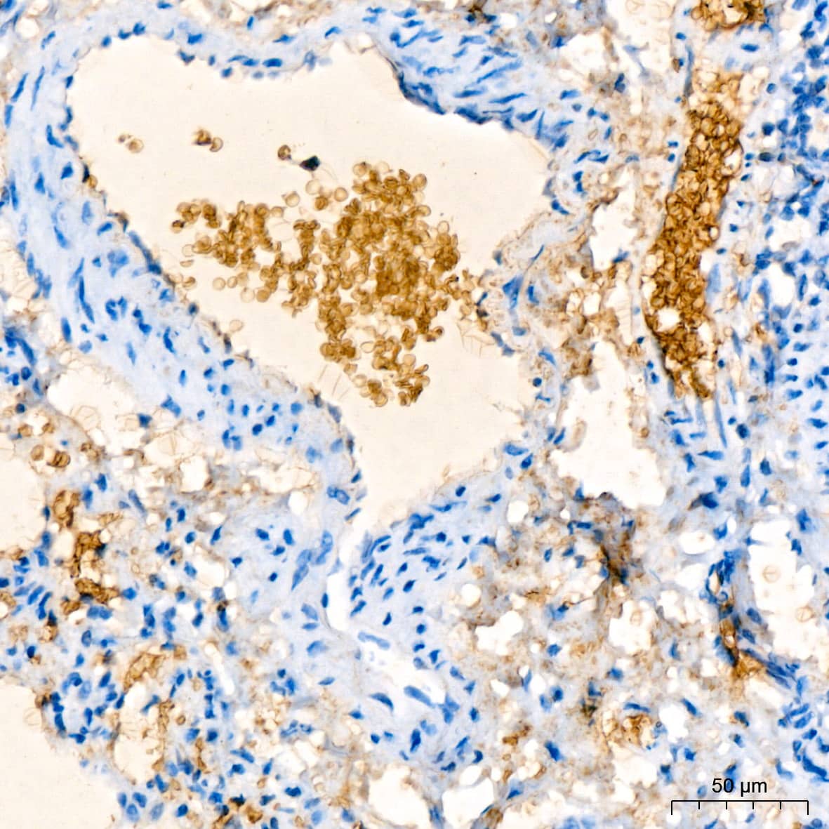 Immunohistochemistry: Hemoglobin A1 Antibody (1R1N7) [NBP3-16804] - Immunohistochemistry analysis of paraffin-embedded Rat lung tissue using Hemoglobin A1 Rabbit mAb at a dilution of 1:200 (40x lens). High pressure antigen retrieval performed with 0.01M Citrate Buffer (pH 6.0) prior to IHC staining.