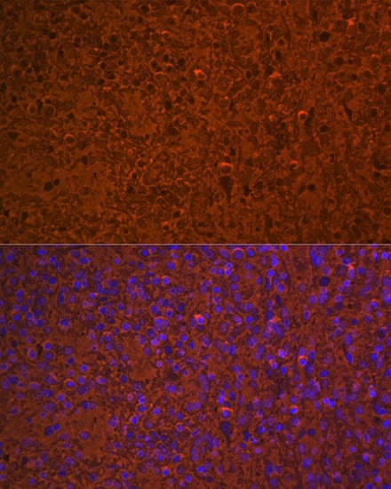 Immunocytochemistry/ Immunofluorescence: Hemoglobin A1 Antibody (1R1N7) [NBP3-16804] - Immunofluorescence analysis of paraffin-embedded human spleen using Hemoglobin A1 (HBA1) Rabbit mAb at dilution of 1:100 (40x lens). Secondary antibody: Cy3-conjugated Goat anti-Rabbit IgG (H+L) at 1:500 dilution. Blue: DAPI for nuclear staining.