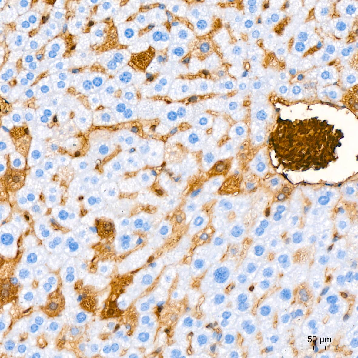 Immunohistochemistry: Hemoglobin A1 Antibody (1R1N7) [NBP3-16804] - Immunohistochemistry analysis of paraffin-embedded Mouse liver tissue using Hemoglobin A1 Rabbit mAb at a dilution of 1:200 (40x lens). High pressure antigen retrieval performed with 0.01M Citrate Buffer (pH 6.0) prior to IHC staining.