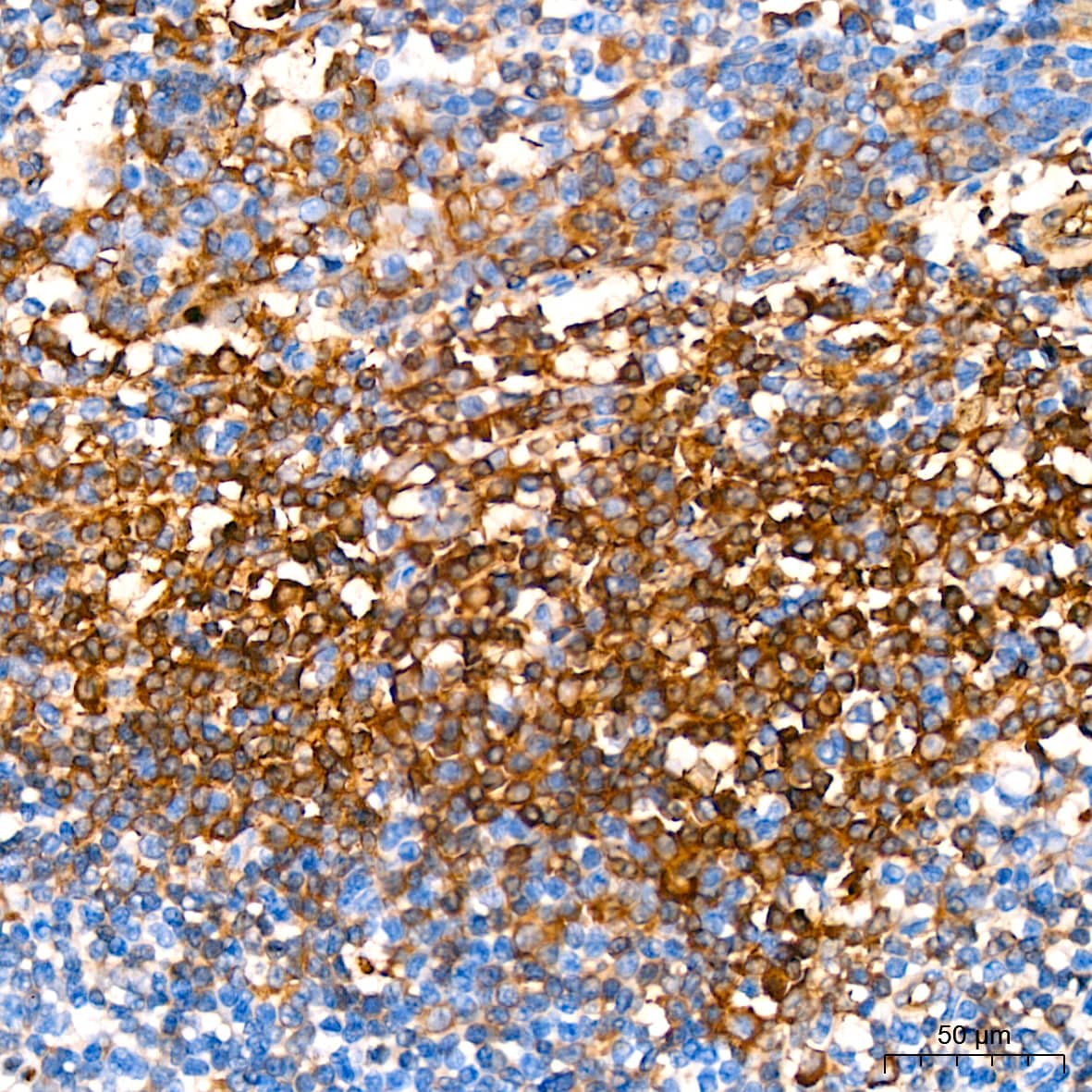 Immunohistochemistry: Hemoglobin A1 Antibody (1R1N7) [NBP3-16804] - Immunohistochemistry analysis of paraffin-embedded Human tonsil tissue using Hemoglobin A1 Rabbit mAb at a dilution of 1:200 (40x lens). High pressure antigen retrieval performed with 0.01M Citrate Buffer (pH 6.0) prior to IHC staining.