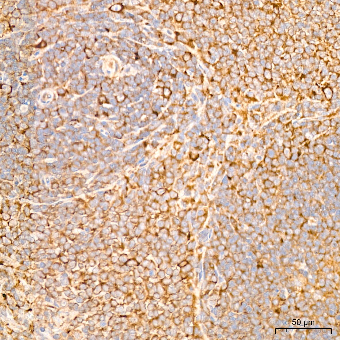Immunohistochemistry: IL-11R alpha Antibody (10Z3S9) [NBP3-16809] - Immunohistochemistry analysis of IL-11R alpha in paraffin-embedded rat spleen tissue using IL-11R alpha Rabbit mAb  at a dilution of 1:400 (40x lens).High pressure antigen retrieval was performed with 0.01 M citrate buffer (pH 6.0) prior to IHC staining.