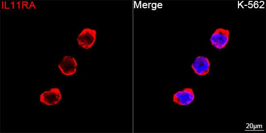 Immunocytochemistry/ Immunofluorescence: IL-11R alpha Antibody (10Z3S9) [NBP3-16809] - Confocal imaging of K-562 cells using IL-11R alpha Rabbit mAb  followed by a further incubation with Cy3 Goat Anti-Rabbit IgG (H+L) . DAPI was used for nuclear staining (Blue). Objective: 100x.