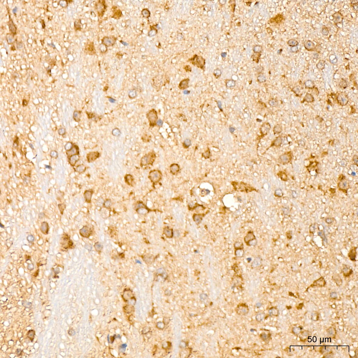 Immunohistochemistry: IL-11R alpha Antibody (10Z3S9) [NBP3-16809] - Immunohistochemistry analysis of IL-11R alpha in paraffin-embedded mouse brain tissue using IL-11R alpha Rabbit mAb  at a dilution of 1:400 (40x lens).High pressure antigen retrieval was performed with 0.01 M citrate buffer (pH 6.0) prior to IHC staining.