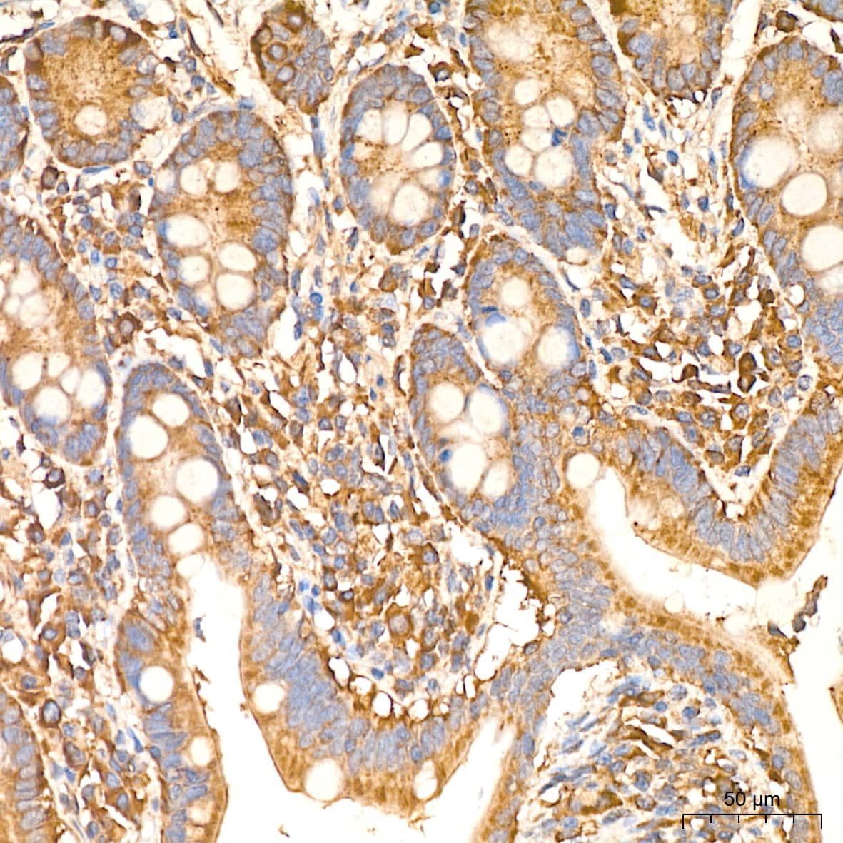 Immunohistochemistry: IL-11R alpha Antibody (10Z3S9) [NBP3-16809] - Immunohistochemistry analysis of IL-11R alpha in paraffin-embedded human colon tissue using IL-11R alpha Rabbit mAb  at a dilution of 1:400 (40x lens).High pressure antigen retrieval was performed with 0.01 M citrate buffer (pH 6.0) prior to IHC staining.