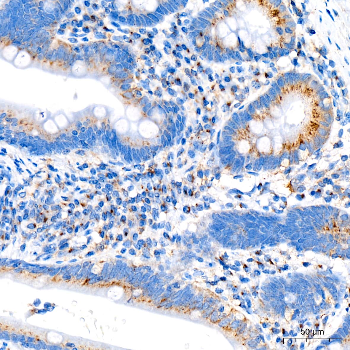 Immunohistochemistry: Syntaxin 16 Antibody (5H6D5) [NBP3-16810] - Immunohistochemistry analysis of paraffin-embedded Human small intestine tissue using Syntaxin 16 Rabbit mAb at a dilution of 1:200 (40x lens). High pressure antigen retrieval was performed with 0.01 M citrate buffer (pH 6.0) prior to IHC staining.