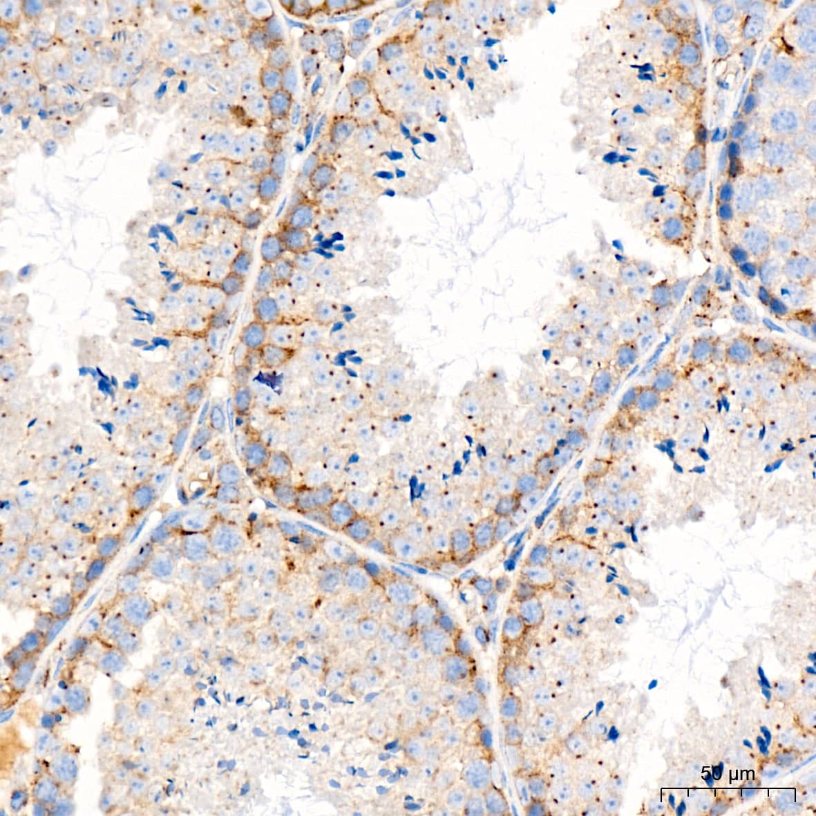 Immunohistochemistry: Syntaxin 16 Antibody (5H6D5) [NBP3-16810] - Immunohistochemistry analysis of paraffin-embedded Mouse testis tissue using Syntaxin 16 Rabbit mAb at a dilution of 1:200 (40x lens). High pressure antigen retrieval was performed with 0.01 M citrate buffer (pH 6.0) prior to IHC staining.