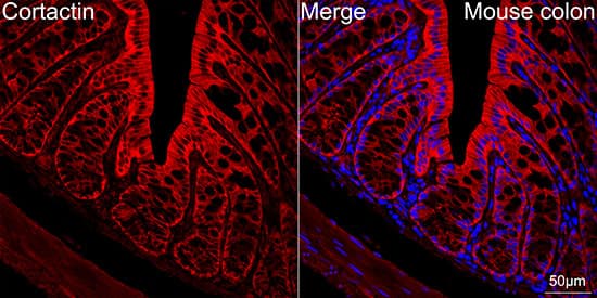 Immunocytochemistry/ Immunofluorescence: Cortactin Antibody (2W5H9) [NBP3-16813] - Confocal imaging of paraffin-embedded Mouse colon tissue using Cortactin Rabbit mAb followed by a further incubation with Cy3 Goat Anti-Rabbit IgG (H+L) . DAPI was used for nuclear staining (Blue). Objective: 40x. Perform high pressure antigen retrieval with 0.01 M citrate buffer (pH 6.0) prior to IF staining.