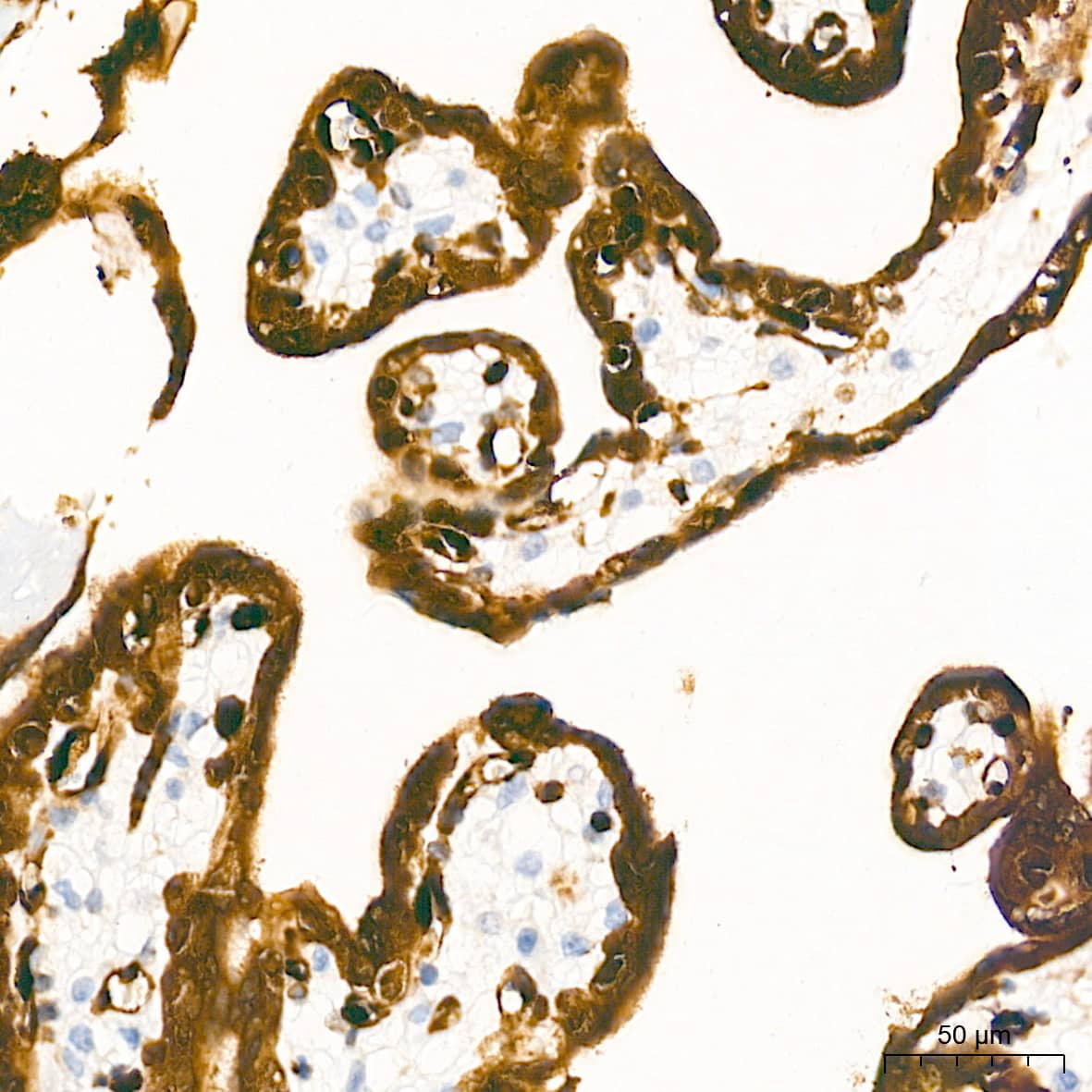 Immunohistochemistry: LIN-28B Antibody (7D7F7) [NBP3-16815] - Immunohistochemistry analysis of paraffin-embedded Human placenta tissue using LIN-28B Rabbit mAb at a dilution of 1:2000 (40x lens). High pressure antigen retrieval performed with 0.01M Tris-EDTA Buffer (pH 9.0) prior to IHC staining.