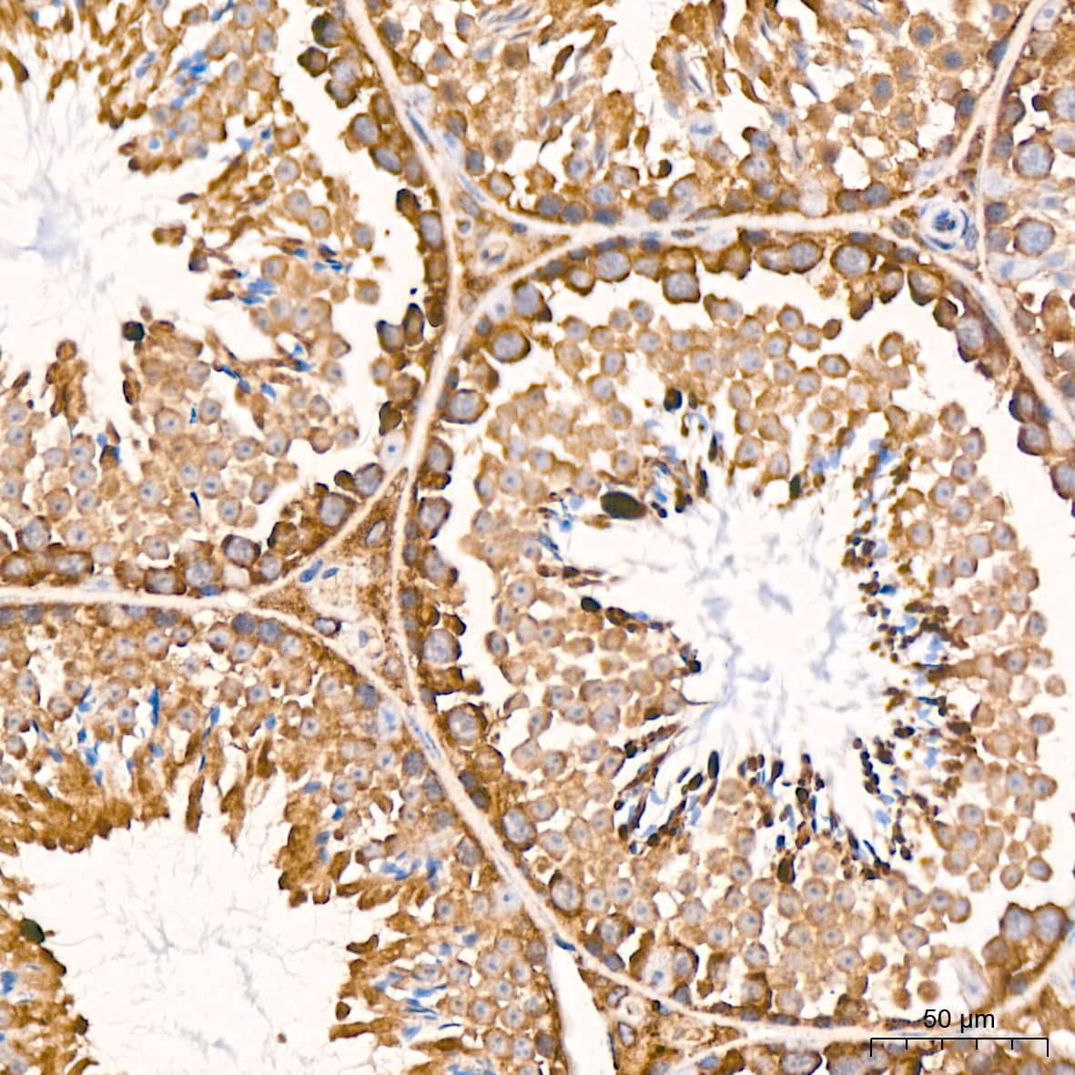 Immunohistochemistry: RPS20 Antibody (9H1D4) [NBP3-16824] - Immunohistochemistry analysis of RPS20 in paraffin-embedded mouse testis tissue using RPS20 Rabbit mAb  at a dilution of 1:800 (40x lens).High pressure antigen retrieval was performed with 0.01 M citrate buffer (pH 6.0) prior to IHC staining.