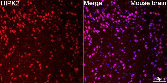 Immunocytochemistry/ Immunofluorescence: HIPK2 Antibody (3Z5P6) [HIPK2] - Confocal imaging of paraffin-embedded Mouse brain tissue using HIPK2 Rabbit mAb  followed by a further incubation with Cy3 Goat Anti-Rabbit IgG (H+L)  . DAPI was used for nuclear staining (Blue). Objective: 40x. Perform microwave antigen retrieval with 0.01 M citrate buffer (pH 6.0) prior to IF staining.