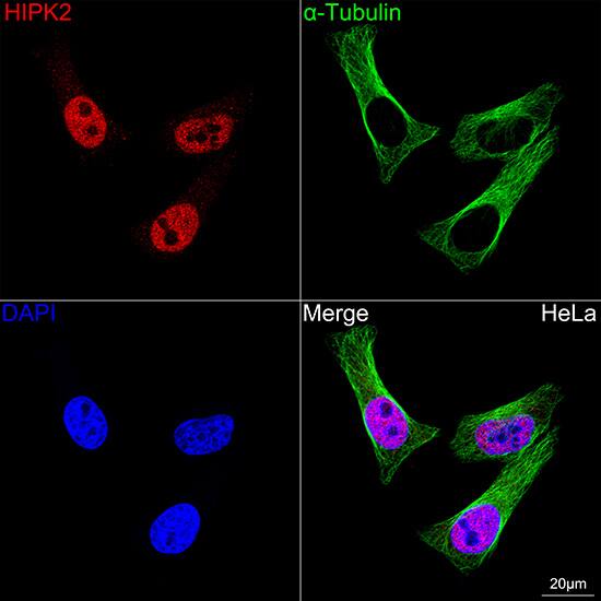 Immunocytochemistry/ Immunofluorescence: HIPK2 Antibody (3Z5P6) [HIPK2] - Confocal imaging of HeLa cells using HIPK2 Rabbit mAb  followed by a further incubation with Cy3 Goat Anti-Rabbit IgG (H+L)  . The cells were counterstained with alpha-Tubulin Mouse mAb  followed by incubation with ABflo 488-conjugated Goat Anti-Mouse IgG (H+L) Ab  (Green). DAPI was used for nuclear staining (Blue). Objective: 100x.