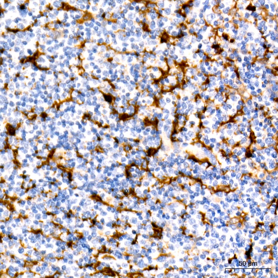 Immunohistochemistry: Fascin Antibody (1B3V6) [NBP3-16828] - Immunohistochemistry analysis of paraffin-embedded Human tonsil using Fascin Rabbit mAb at dilution of 1:100 (40x lens). Microwave antigen retrieval performed with 0.01M Tris/EDTA Buffer (pH 9.0) prior to IHC staining.