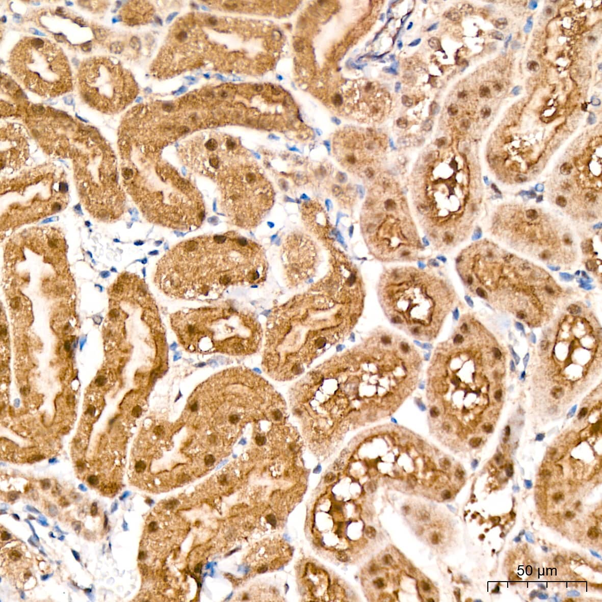 Immunohistochemistry: PSMD14 Antibody (5V0H3) [NBP3-16837] - Immunohistochemistry analysis of paraffin-embedded Mouse kidney tissue using PSMD14 Rabbit mAb at a dilution of 1:200 (40x lens). High pressure antigen retrieval performed with 0.01M Citrate Bufferr (pH 6.0) prior to IHC staining.