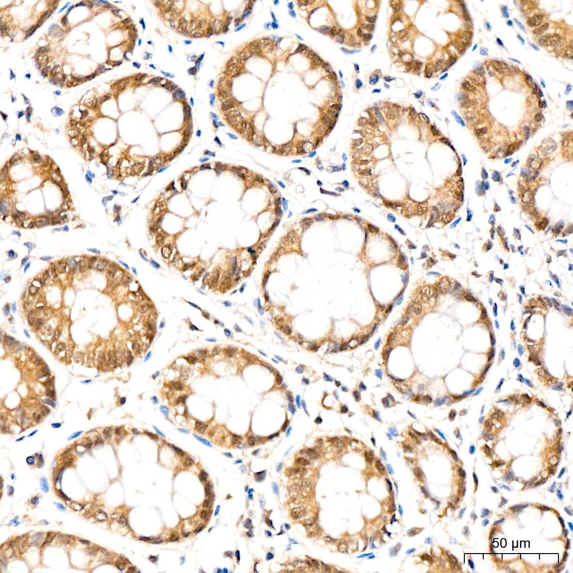 Immunohistochemistry: PSMD14 Antibody (5V0H3) [NBP3-16837] - Immunohistochemistry analysis of paraffin-embedded Human colon tissue using PSMD14 Rabbit mAb at a dilution of 1:200 (40x lens). High pressure antigen retrieval performed with 0.01M Citrate Bufferr (pH 6.0) prior to IHC staining.