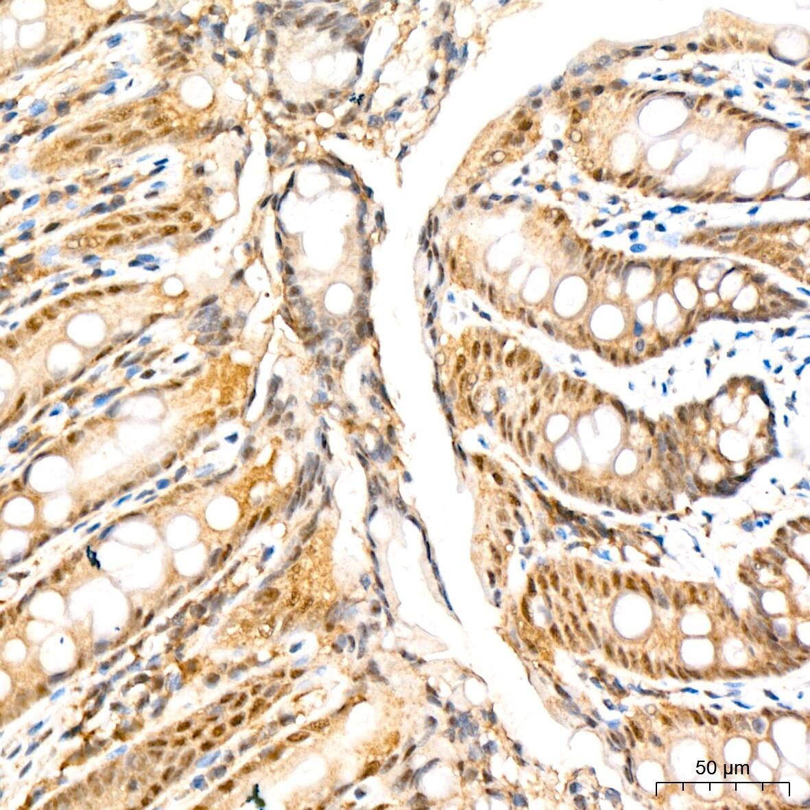 Immunohistochemistry: PSMD14 Antibody (5V0H3) [NBP3-16837] - Immunohistochemistry analysis of paraffin-embedded Rat colon tissue using PSMD14 Rabbit mAb at a dilution of 1:200 (40x lens). High pressure antigen retrieval performed with 0.01M Citrate Bufferr (pH 6.0) prior to IHC staining.
