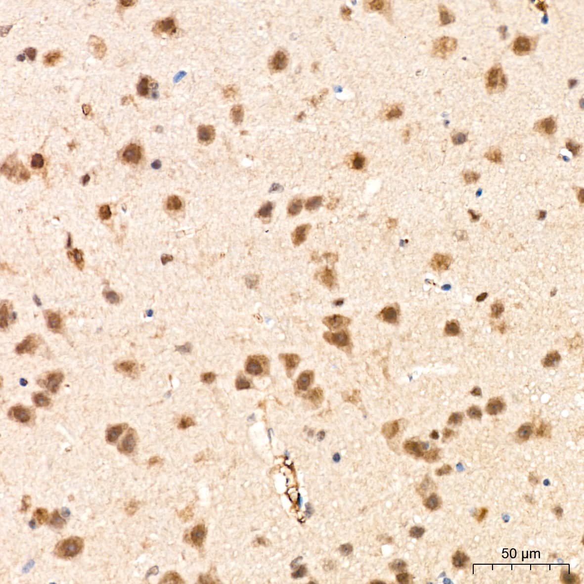 Immunohistochemistry: PSMD14 Antibody (5V0H3) [NBP3-16837] - Immunohistochemistry analysis of paraffin-embedded Mouse brain tissue using PSMD14 Rabbit mAb at a dilution of 1:200 (40x lens). High pressure antigen retrieval performed with 0.01M Citrate Bufferr (pH 6.0) prior to IHC staining.