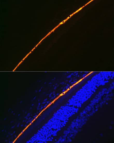 Immunocytochemistry/ Immunofluorescence: RPE65 Antibody (5X1F6) [NBP3-16840] - Immunofluorescence analysis of paraffin-embedded rat eye using RPE65 Rabbit mAb at dilution of 1:100 (40x lens). Secondary antibody: Cy3-conjugated Goat anti-Rabbit IgG (H+L) at 1:500 dilution. Blue: DAPI for nuclear staining.