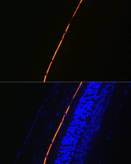 Immunocytochemistry/ Immunofluorescence: RPE65 Antibody (5X1F6) [NBP3-16840] - Immunofluorescence analysis of paraffin-embedded mouse eye using RPE65 Rabbit mAb at dilution of 1:100 (40x lens). Secondary antibody: Cy3-conjugated Goat anti-Rabbit IgG (H+L) at 1:500 dilution. Blue: DAPI for nuclear staining.