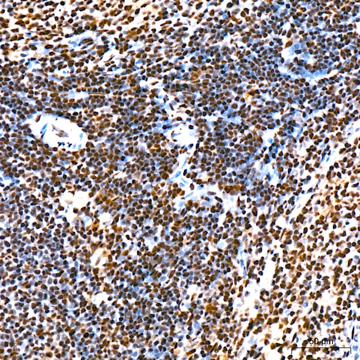 Immunohistochemistry: SAP130 Antibody (3K1X4) [NBP3-16842] - Immunohistochemistry analysis of SAP130 in paraffin-embedded rat spleen tissue using SAP130 Rabbit mAb  at a dilution of 1:200 (40x lens). High pressure antigen retrieval was performed with 0.01 M citrate buffer (pH 6.0) prior to IHC staining.
