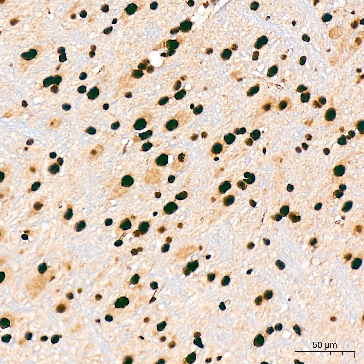 Immunohistochemistry: SAP130 Antibody (3K1X4) [NBP3-16842] - Immunohistochemistry analysis of SAP130 in paraffin-embedded mouse brain tissue using SAP130 Rabbit mAb  at a dilution of 1:200 (40x lens). High pressure antigen retrieval was performed with 0.01 M citrate buffer (pH 6.0) prior to IHC staining.