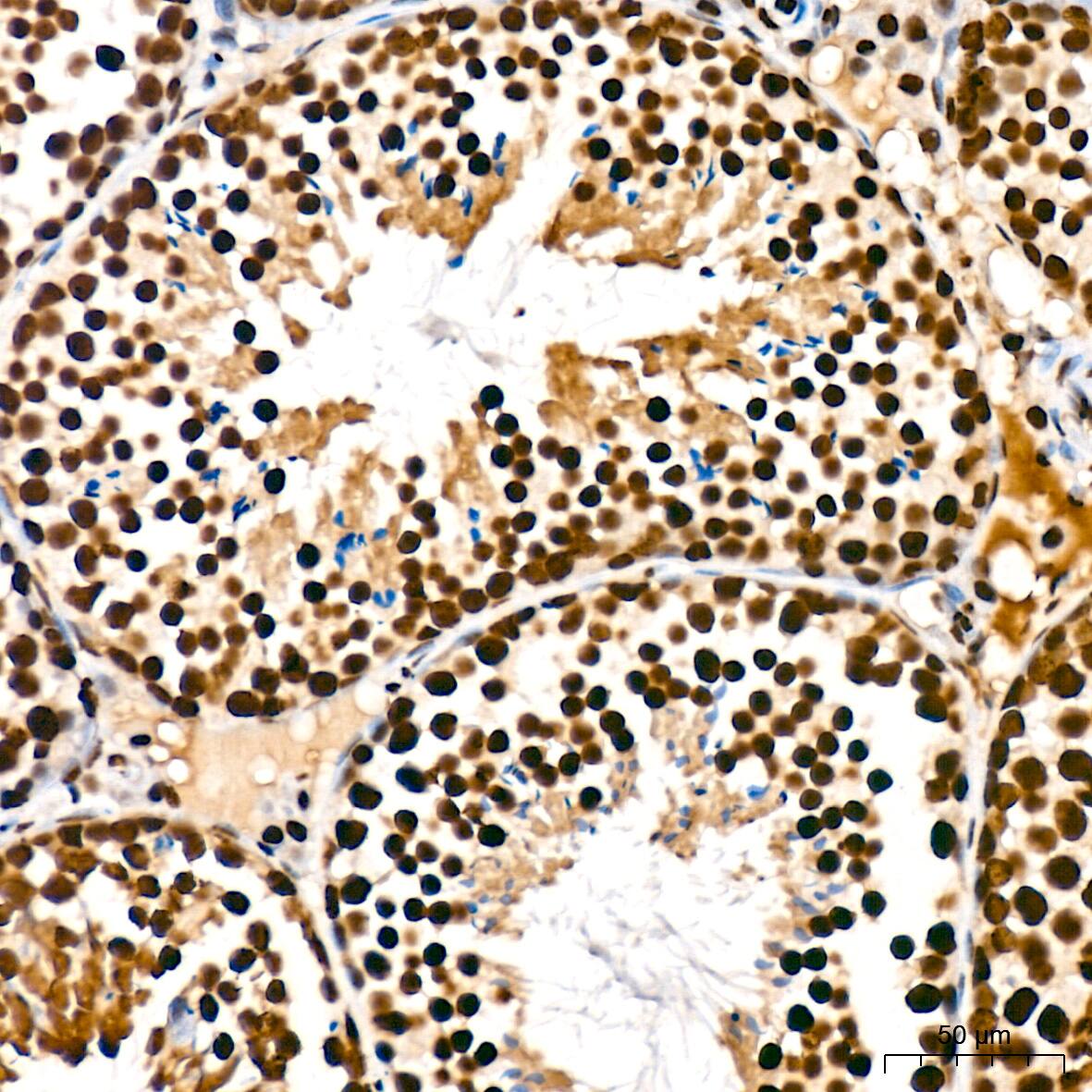 Immunohistochemistry: SAP130 Antibody (3K1X4) [NBP3-16842] - Immunohistochemistry analysis of SAP130 in paraffin-embedded mouse testis tissue using SAP130 Rabbit mAb  at a dilution of 1:200 (40x lens). High pressure antigen retrieval was performed with 0.01 M citrate buffer (pH 6.0) prior to IHC staining.