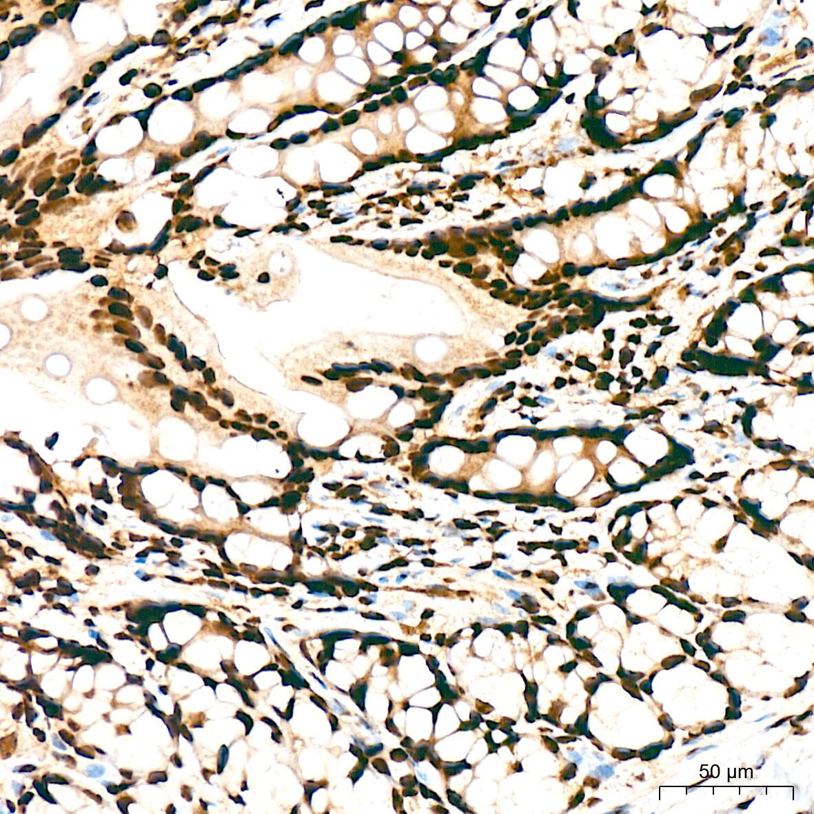 Immunohistochemistry SAP130 Antibody (3K1X4)