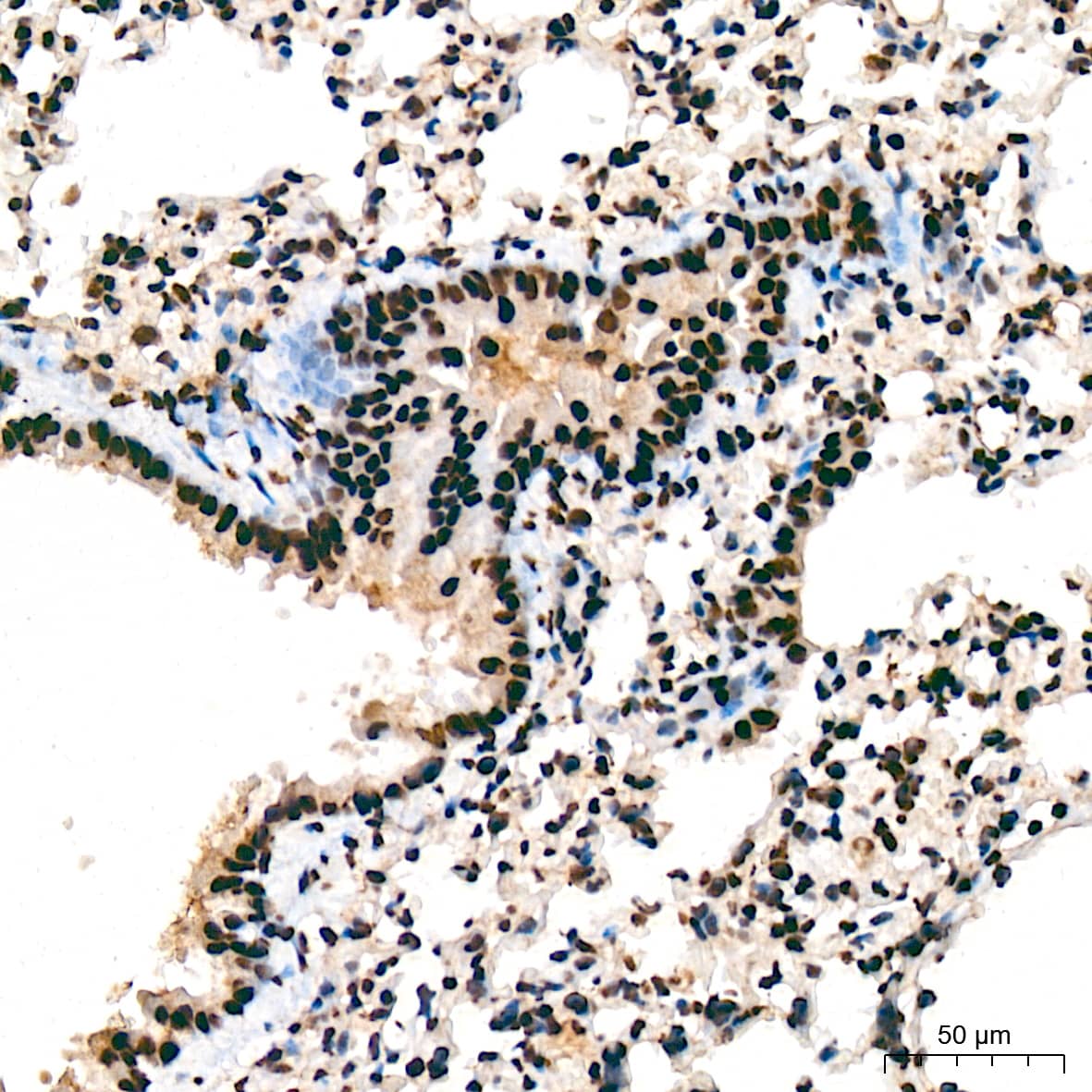 Immunohistochemistry: SAP130 Antibody (3K1X4) [NBP3-16842] - Immunohistochemistry analysis of SAP130 in paraffin-embedded mouse lung tissue using SAP130 Rabbit mAb  at a dilution of 1:200 (40x lens). High pressure antigen retrieval was performed with 0.01 M citrate buffer (pH 6.0) prior to IHC staining.