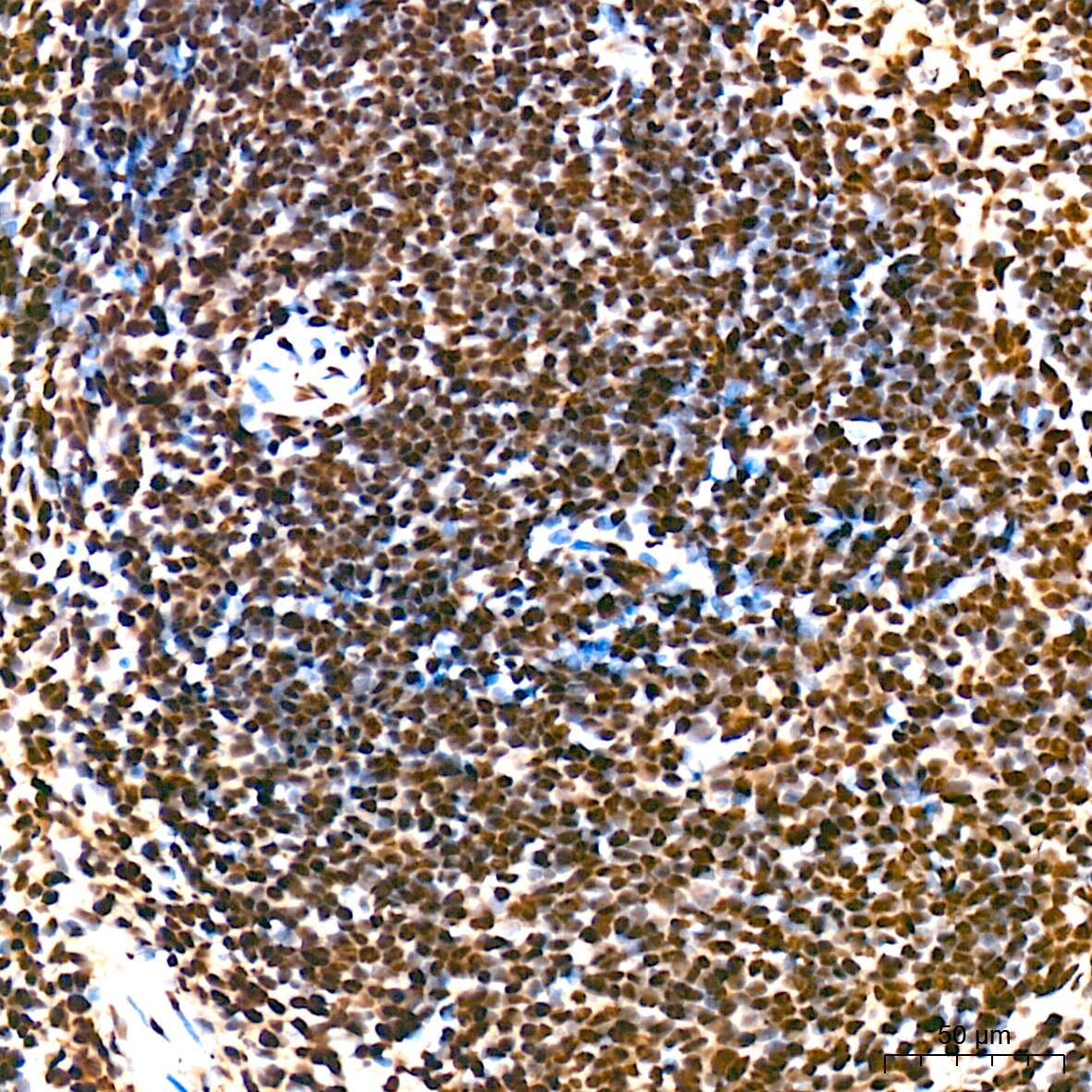 Immunohistochemistry: SAP130 Antibody (3K1X4) [NBP3-16842] - Immunohistochemistry analysis of SAP130 in paraffin-embedded mouse spleen tissue using SAP130 Rabbit mAb  at a dilution of 1:200 (40x lens). High pressure antigen retrieval was performed with 0.01 M citrate buffer (pH 6.0) prior to IHC staining.
