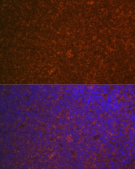 Immunocytochemistry/ Immunofluorescence: CARD11/CARMA1 Antibody (8N4C9) [NBP3-16849] - Immunofluorescence analysis of paraffin-embedded mouse spleen using CARD11/CARMA1 Rabbit mAb at dilution of 1:100 (40x lens). Secondary antibody: Cy3 Goat Anti-Rabbit IgG (H+L) at 1:500 dilution. Blue: DAPI for nuclear staining.