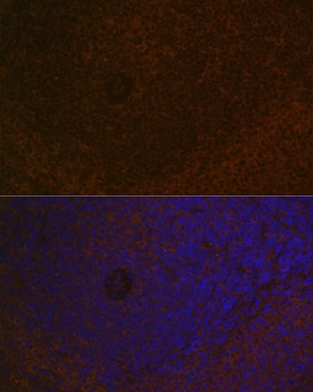 Immunocytochemistry/ Immunofluorescence: CARD11/CARMA1 Antibody (8N4C9) [NBP3-16849] - Immunofluorescence analysis of paraffin-embedded rat spleen using CARD11/CARMA1 Rabbit mAb at dilution of 1:100 (40x lens). Secondary antibody: Cy3 Goat Anti-Rabbit IgG (H+L) at 1:500 dilution. Blue: DAPI for nuclear staining.