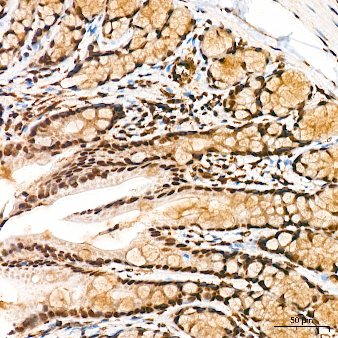 Immunohistochemistry: PRP19 Antibody (4M3Z1) [NBP3-16853] - Immunohistochemistry analysis of PRP19 in paraffin-embedded rat colon tissue using PRP19 Rabbit mAb  at a dilution of 1:200 (40x lens). High pressure antigen retrieval was performed with 0.01 M citrate buffer (pH 6.0) prior to IHC staining.