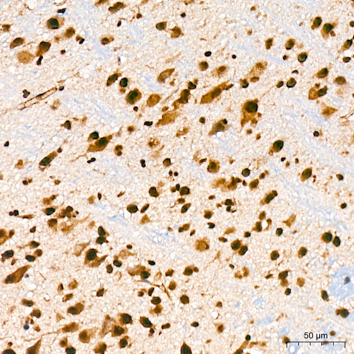 Immunohistochemistry: PRP19 Antibody (4M3Z1) [NBP3-16853] - Immunohistochemistry analysis of PRP19 in paraffin-embedded mouse brain tissue using PRP19 Rabbit mAb  at a dilution of 1:200 (40x lens). High pressure antigen retrieval was performed with 0.01 M citrate buffer (pH 6.0) prior to IHC staining.