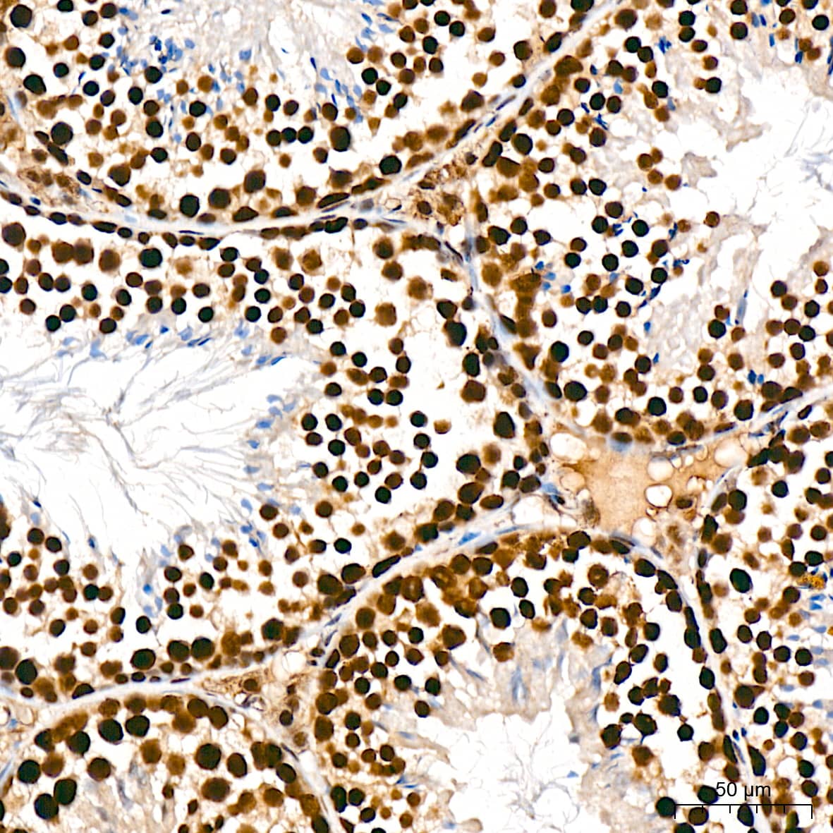 Immunohistochemistry: PRP19 Antibody (4M3Z1) [NBP3-16853] - Immunohistochemistry analysis of PRP19 in paraffin-embedded mouse testis tissue using PRP19 Rabbit mAb  at a dilution of 1:200 (40x lens). High pressure antigen retrieval was performed with 0.01 M citrate buffer (pH 6.0) prior to IHC staining.